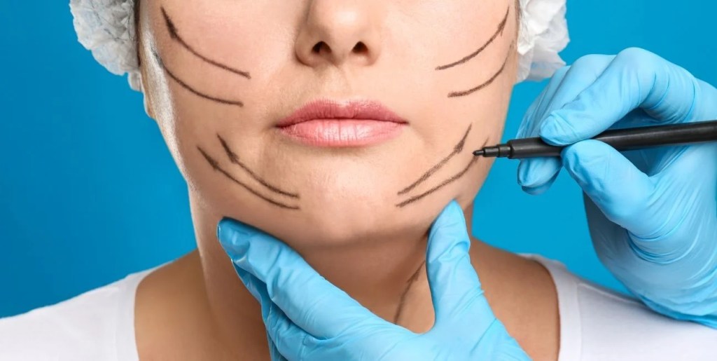 Cuando la Justicia amplía la cobertura: cirugía de feminización facial debe ser íntegramente cubierta por una&nbsp;prepaga